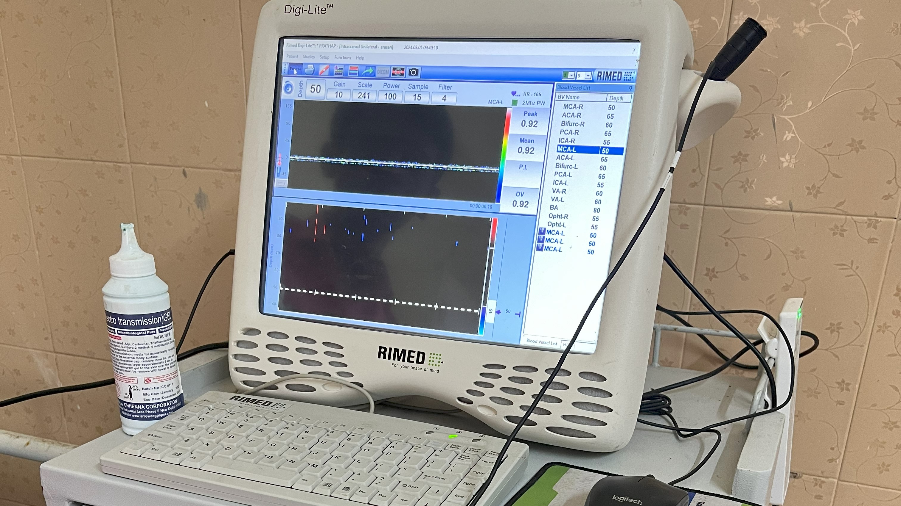 Stroke ICU Image 4