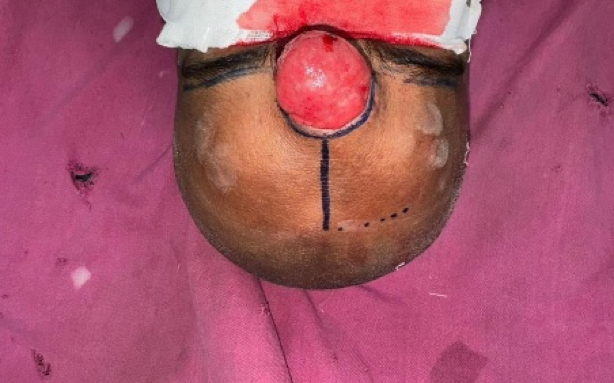 Plastic Surgery