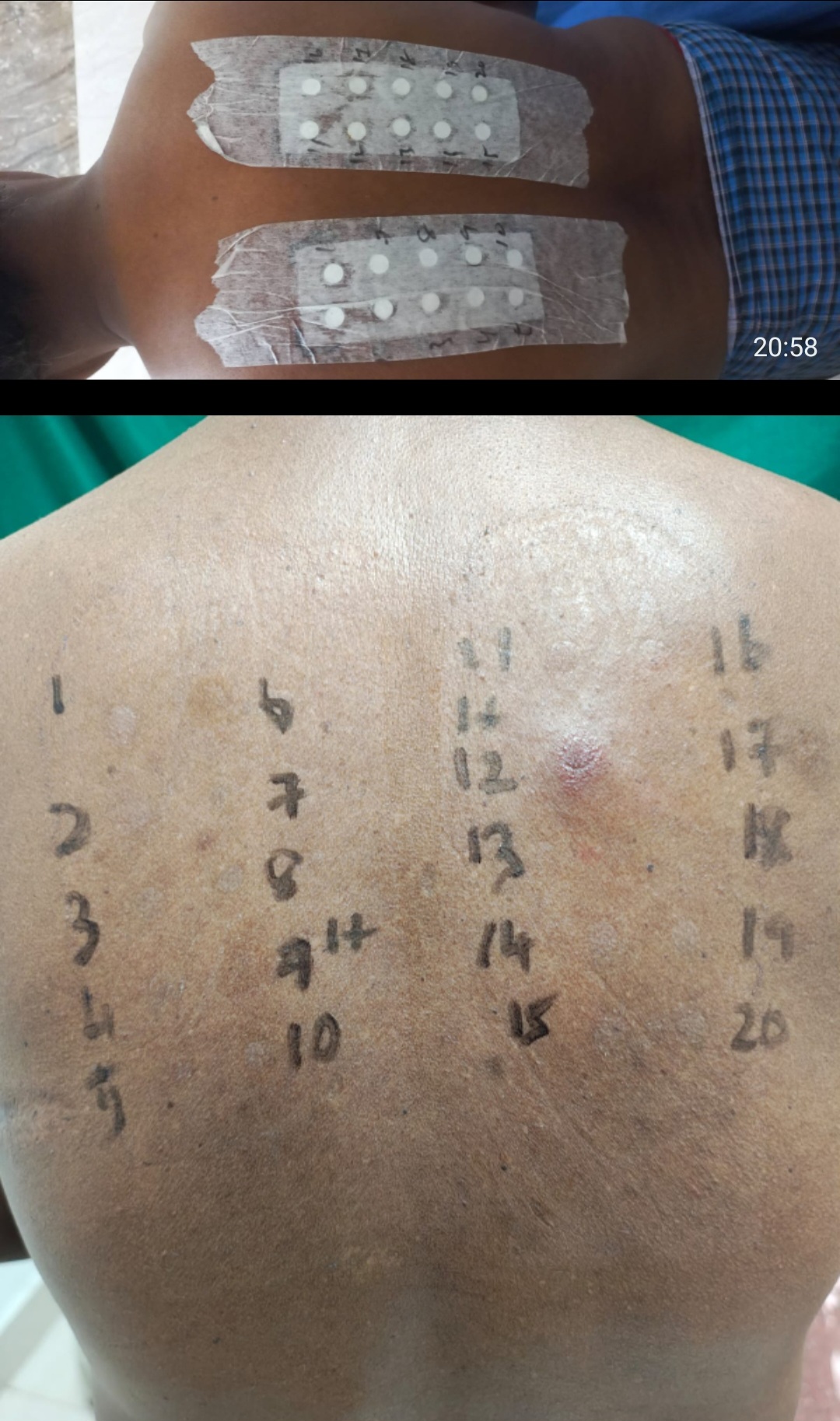 Patch Test